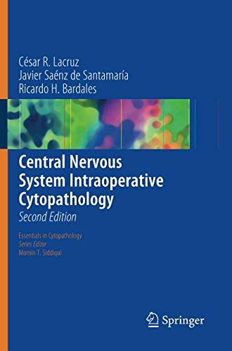 Central Nervous System Intraoperative Cytopathology (Essentials in Cytopathology, Band 13)