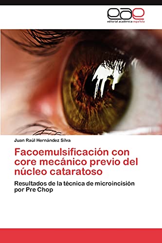Facoemulsificación con core mecánico previo del núcleo cataratoso: Resultados de la técnica de microincisión por Pre Chop