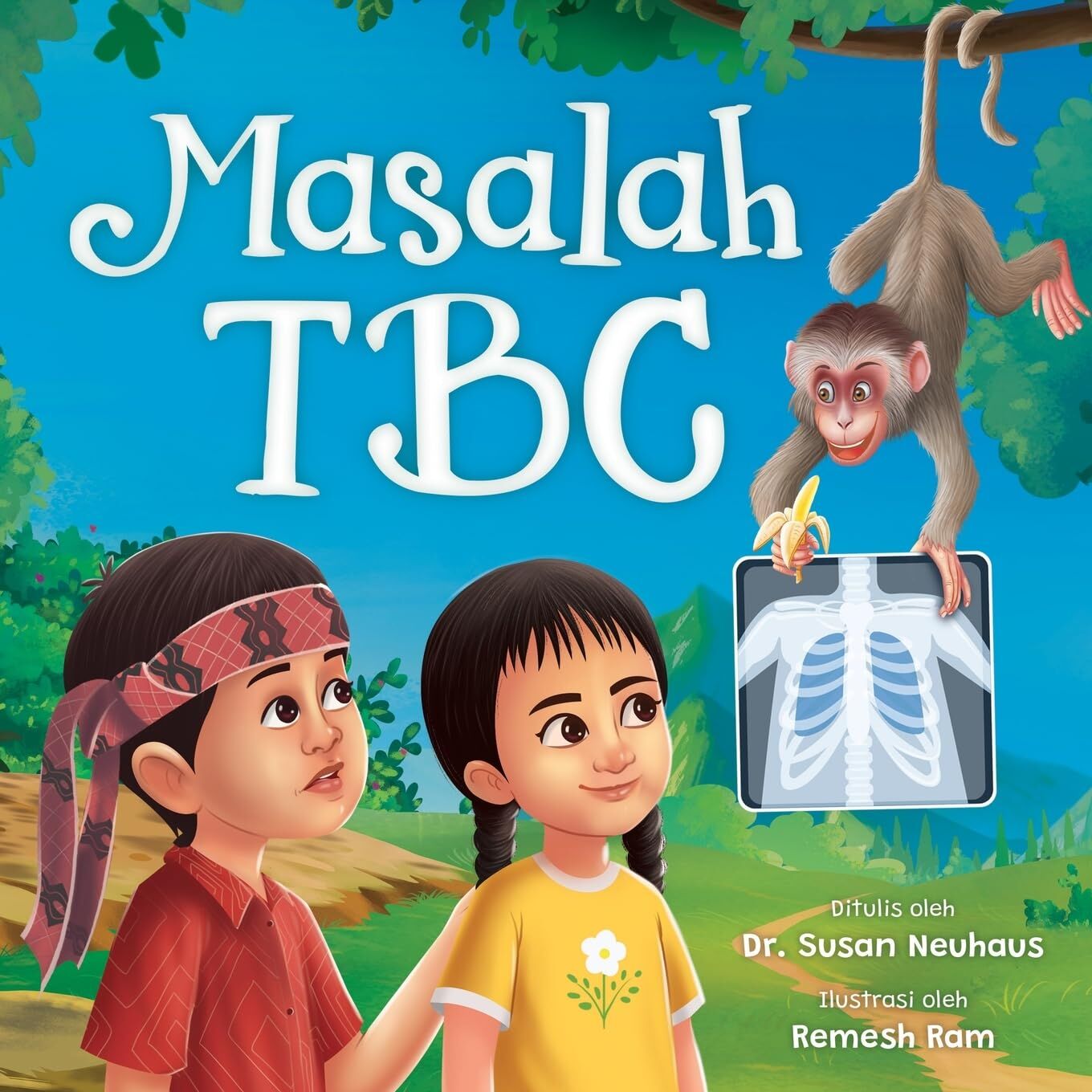 Masalah TBC
