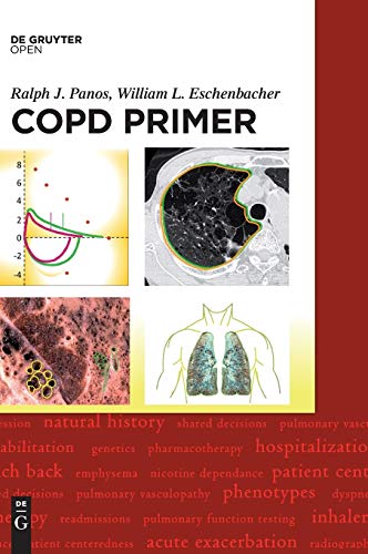 A COPD Primer