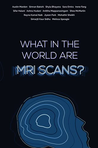 What in the world are MRI Scans?