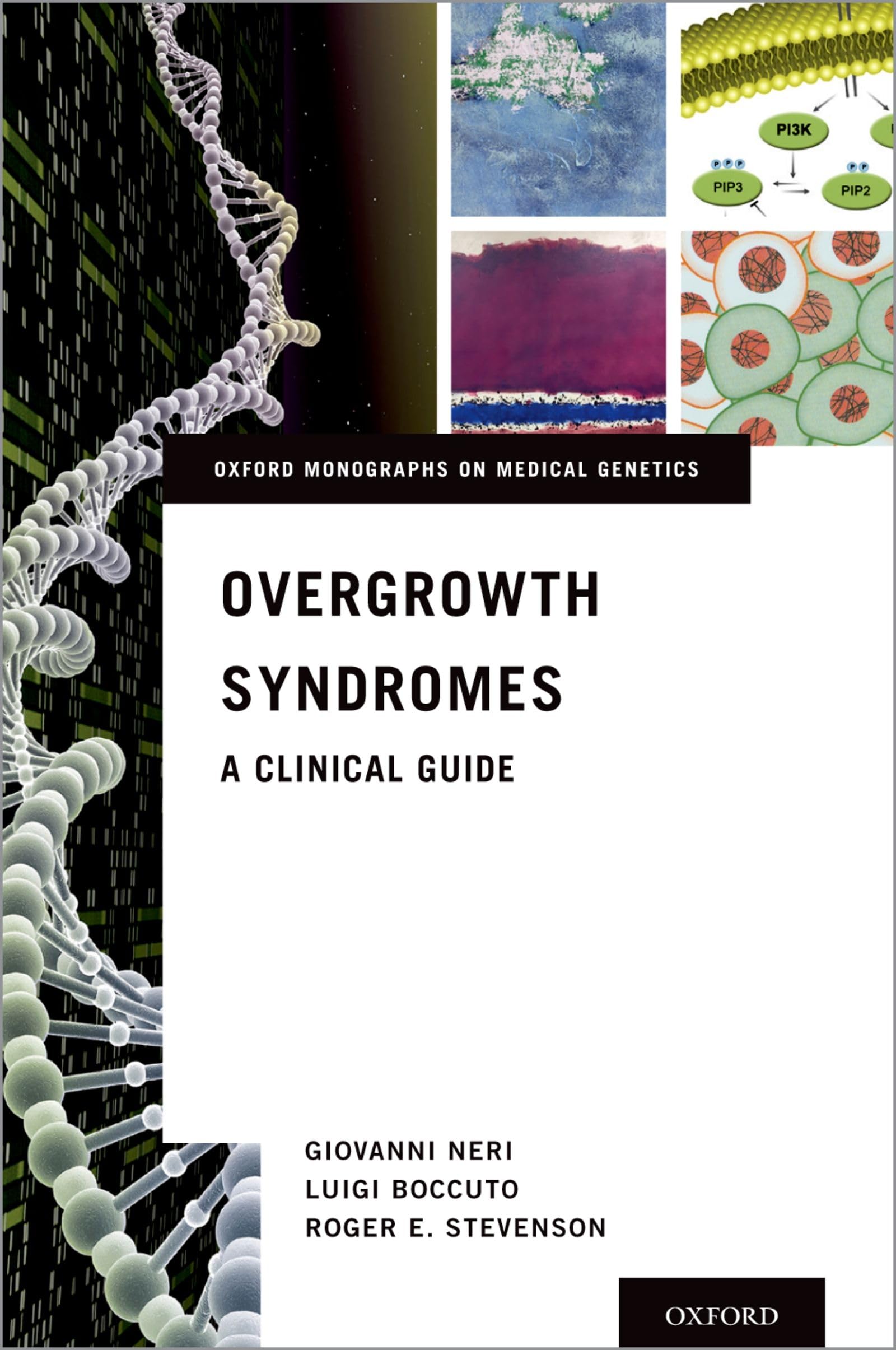 Overgrowth Syndromes: A Clinical Guide (Oxford Monographs on Medical Genetics, 71, Band 71)