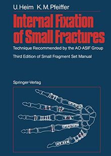 Internal Fixation of Small Fractures: Technique Recommended by the A.O.-A.S.I.F. Group