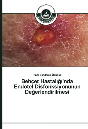 Behçet Hastalığı'nda Endotel Disfonksiyonunun Değerlendirilmesi