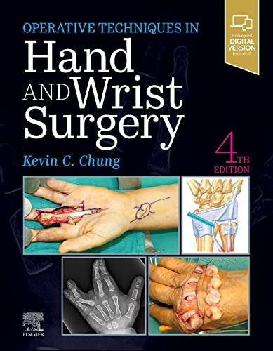 Operative Techniques Hand and Wrist Surgery - Kevin C Chung Gebunden