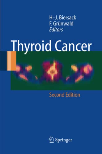 Thyroid Cancer