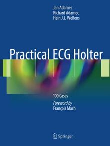 Practical ECG Holter: 100 Cases