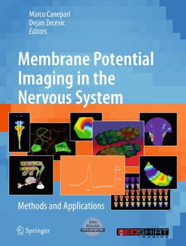 Membrane Potential Imaging in the Nervous System: Methods and Applications