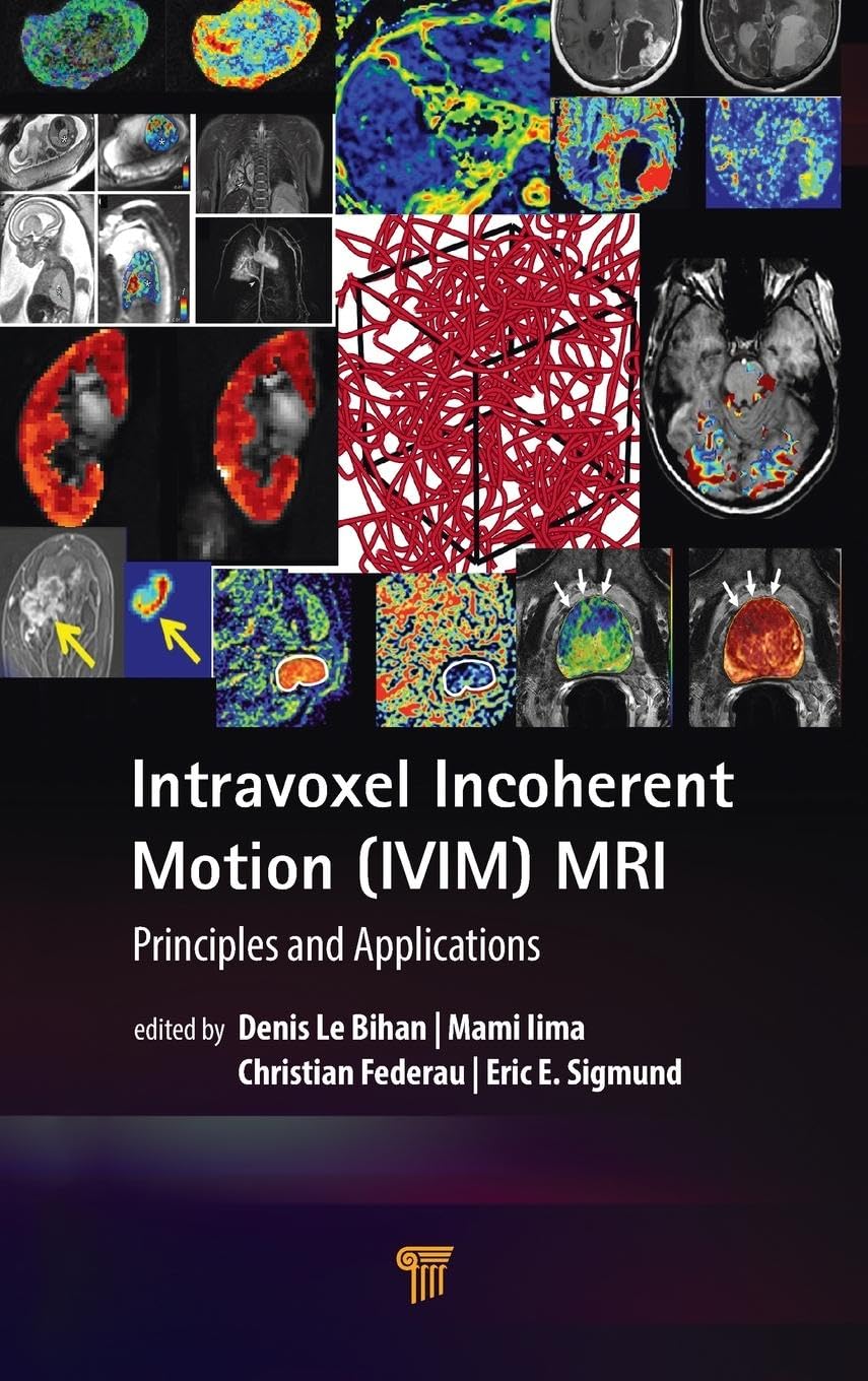 Intravoxel Incoherent Motion (IVIM) MRI: Principles and Applications