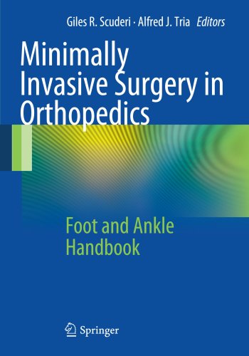 Minimally Invasive Surgery in Orthopedics: Foot and Ankle Handbook