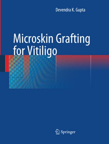 Microskin Grafting for Vitiligo