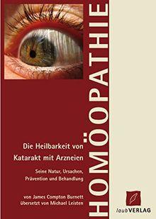 Die Behandlung von Katarrakt: Die Heilbarkeit von Grauem Star mit Arzneien ... Behandlung) von J. Compton Burnett, M. D.