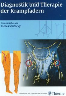 Diagnostik und Therapie der Krampfadern: Mit CD-ROM: Krampfadern erkennen und behandeln. Anatomie und Dopplersonographie der Venen und Venenklappen, ... und Vorschläge zur aktiven Selbstbehandlung