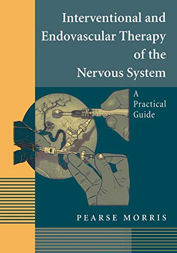 Interventional and Endovascular Therapy of the Nervous System: A Practical Guide