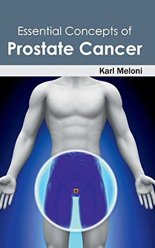 Essential Concepts of Prostate Cancer