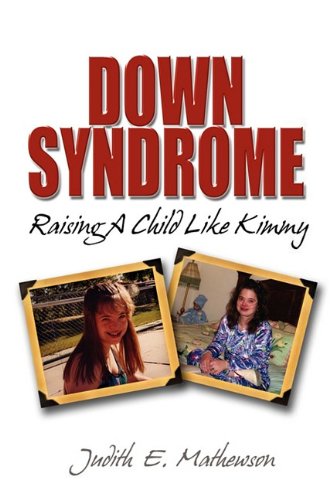 Down Syndrome, Raising A Child Like Kimmy