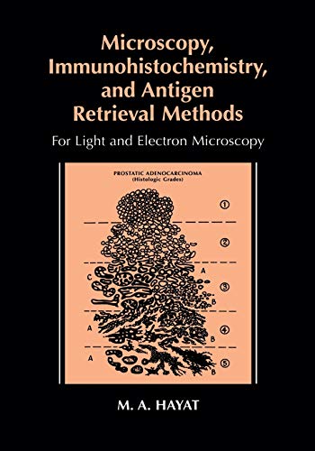 Microscopy, Immunohistochemistry, and Antigen Retrieval Methods: For Light And Electron Microscopy