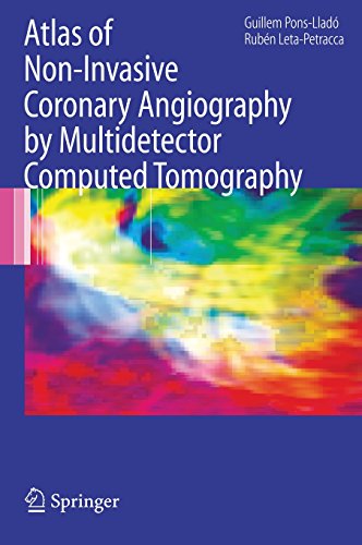 Atlas of Non-Invasive Coronary Angiography by Multidetector Computed Tomography (Developments in Cardiovascular Medicine)