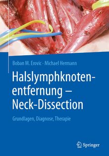 Halslymphknotenentfernung – Neck-Dissection: Grundlagen, Diagnostik, Therapie