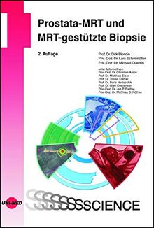 Prostata-MRT und MRT-gestützte Biopsie (UNI-MED Science)