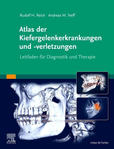 Atlas der Kiefergelenkerkrankungen und -verletzungen: Leitfaden für Diagnostik und Therapie