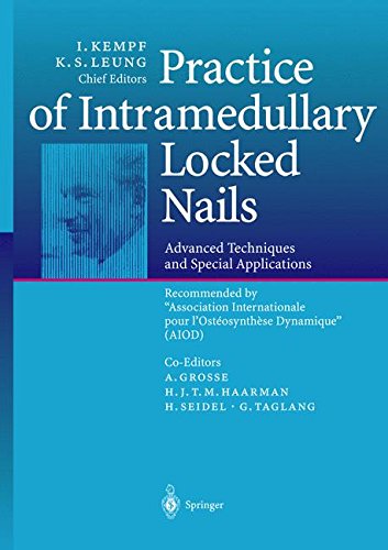 Practice of Intramedullary Locked Nails: Advanced Techniques and Special Applications Recommended by “Association Internationale pour l’Ostéosynthèse Dynamique” (AIOD)
