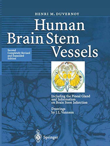 J. Guyot Human Brain Stem Vessels, Including The Pineal Gland And Information On Brain Stem Infarction