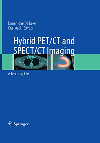 Hybrid PET/CT and SPECT/CT Imaging: A Teaching File