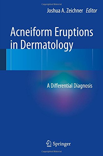 Acneiform Eruptions in Dermatology: A Differential Diagnosis