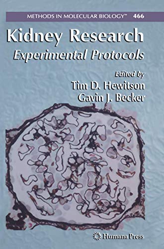 Kidney Research: Experimental Protocols (Methods in Molecular Biology, Band 466)