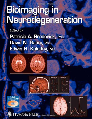 Bioimaging in Neurodegeneration (Contemporary Neuroscience)