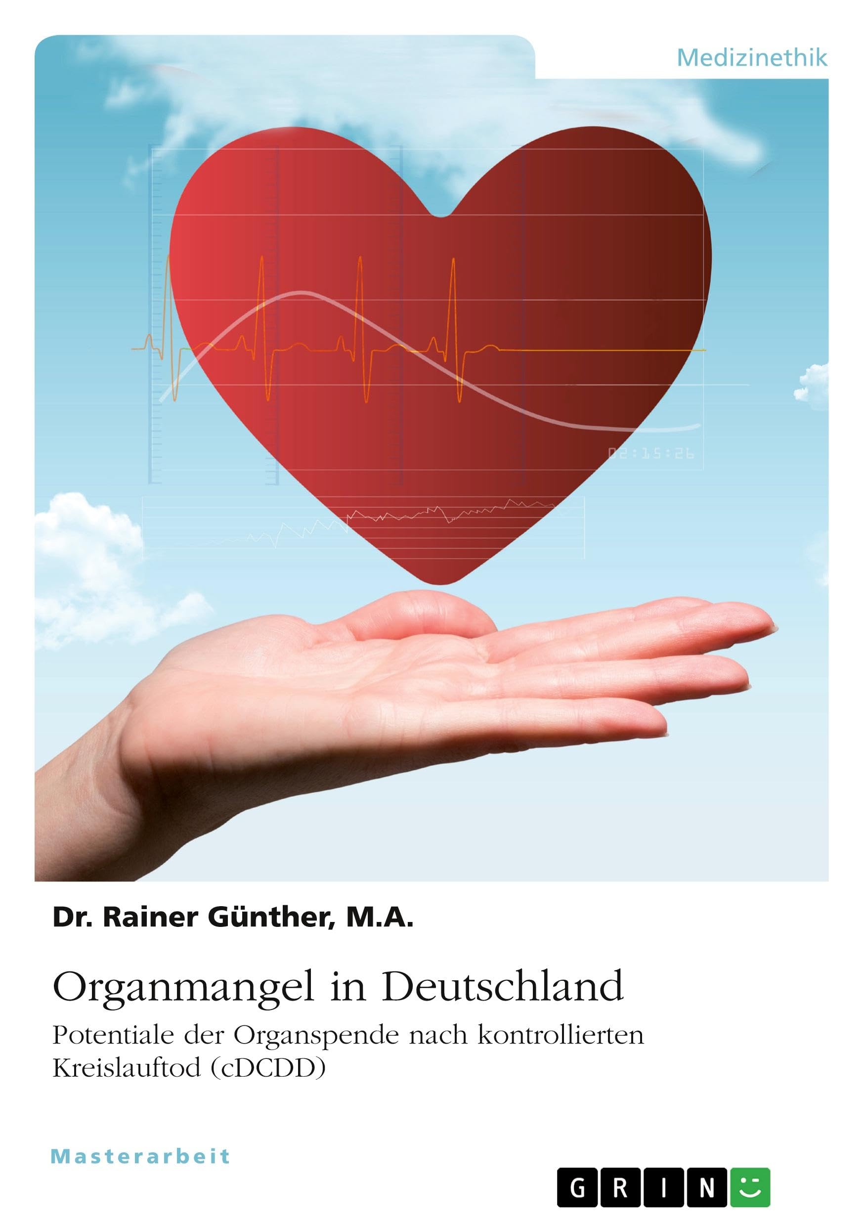 Organmangel in Deutschland. Potenziale der kontrollierten Organspende nach Kreislauftod (cDCDD)