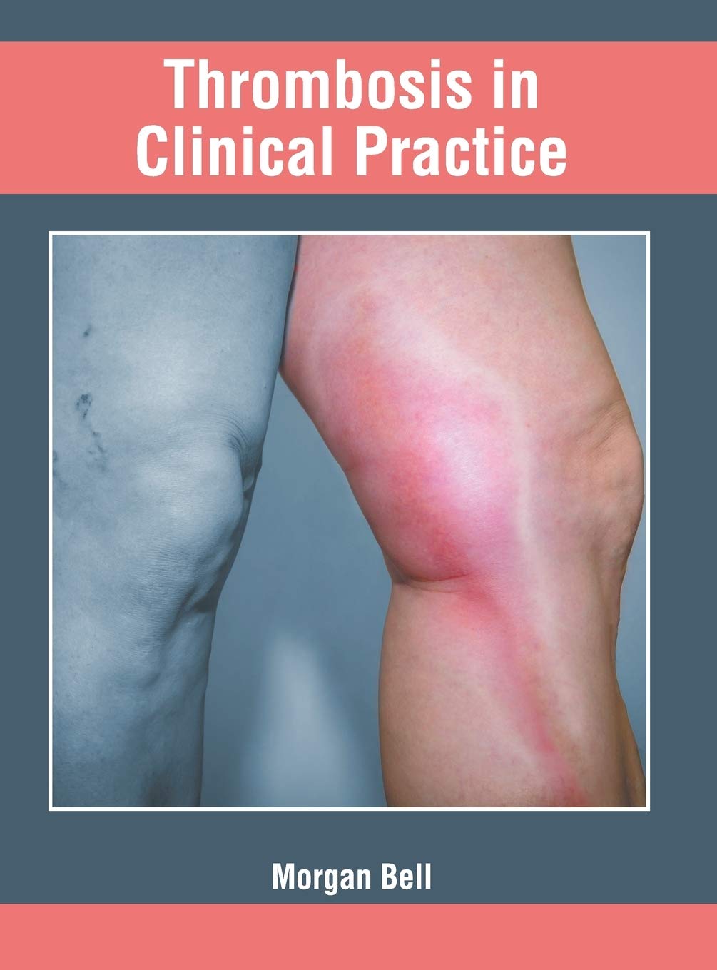 Thrombosis in Clinical Practice