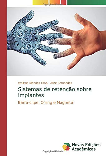 Sistemas de retenção sobre implantes: Barra-clipe, O'ring e Magneto
