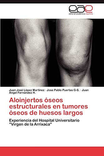 Aloinjertos óseos estructurales en tumores óseos de huesos largos: Experiencia del Hospital Universitario Virgen de la Arrixaca