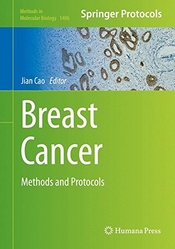 Breast Cancer: Methods and Protocols (Methods in Molecular Biology)