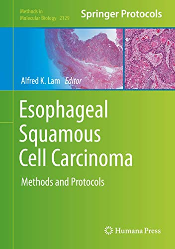 Esophageal Squamous Cell Carcinoma: Methods and Protocols (Methods in Molecular Biology, 2129, Band 2129)