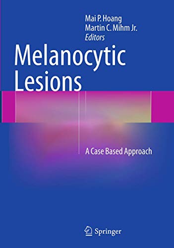 Melanocytic Lesions: A Case Based Approach