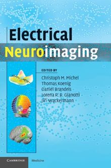 Electrical Neuroimaging (Cambridge Medicine)