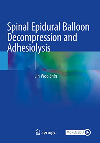 Spinal Epidural Balloon Decompression and Adhesiolysis