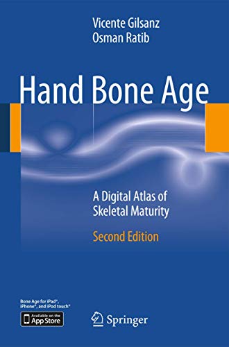 Hand Bone Age - Vicente Gilsanz Osman Ratib Kartoniert (TB)