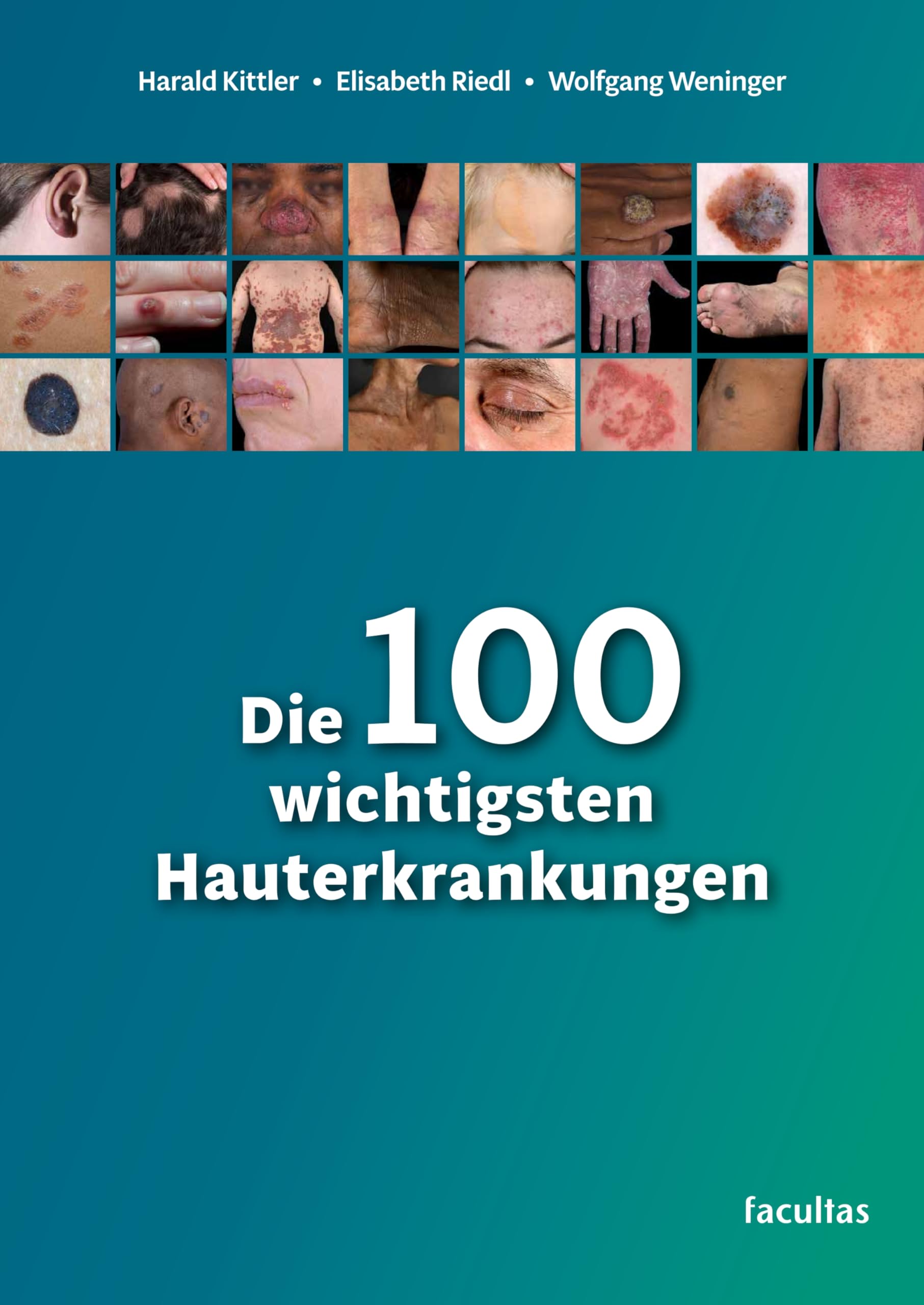 Kittler Harald Die 100 wichtigsten Hauterkrankungen