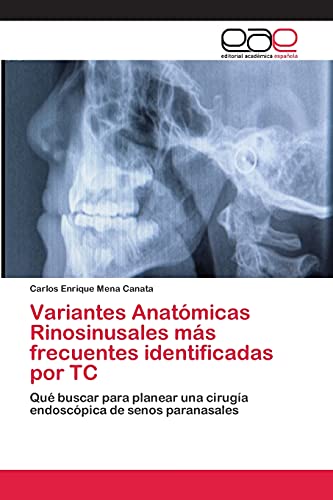 Variantes Anatómicas Rinosinusales más frecuentes identificadas por TC: Qué buscar para planear una cirugía endoscópica de senos paranasales