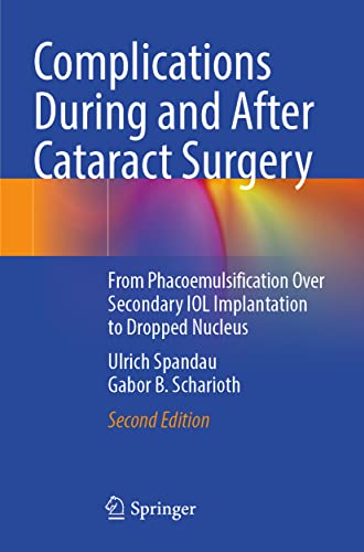 Complications During and After Cataract Surgery: From Phacoemulsification Over Secondary IOL Implantation to Dropped Nucleus
