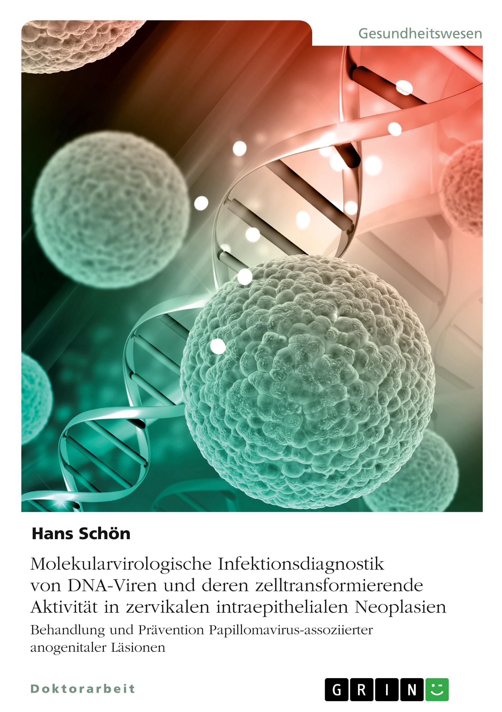 Molekularvirologische Infektionsdiagnostik von DNA-Viren und deren zelltransformierende Aktivität in zervikalen intraepithelialen Neoplasien: ... anogenitaler Läsionen