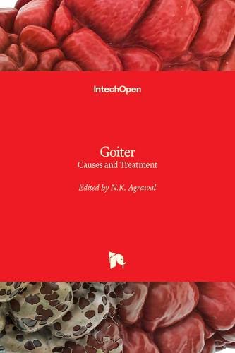 Goiter: Causes and Treatment