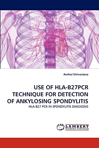 USE OF HLA-B27PCR TECHNIQUE FOR DETECTION OF ANKYLOSING SPONDYLITIS: HLA-B27 PCR IN SPONDYLITIS DIAGNOSIS