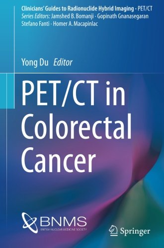 PET/CT in Colorectal Cancer (Clinicians' Guides to Radionuclide Hybrid Imaging)