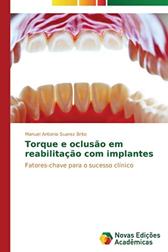 Torque e oclusão em reabilitação com implantes: Fatores-chave para o sucesso clínico