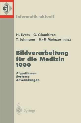 Bildverarbeitung für die Medizin 1999: Algorithmen - Systeme - Anwendungen. Proceedings des Workshops am 4. und 5. März 1999 in Heidelberg (Informatik Aktuell) (German Edition)